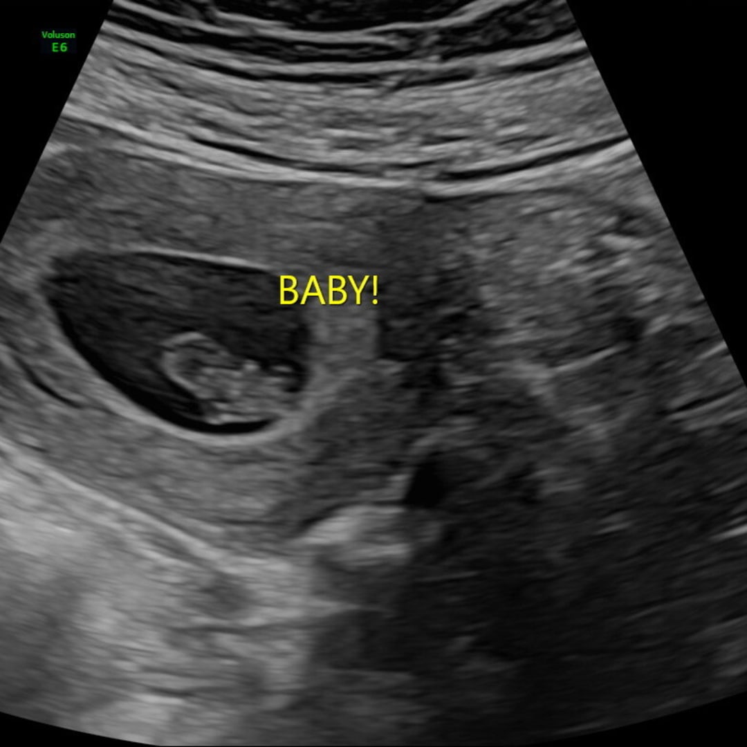 Photo shared by Kaitlyn for their Babylist baby registry.