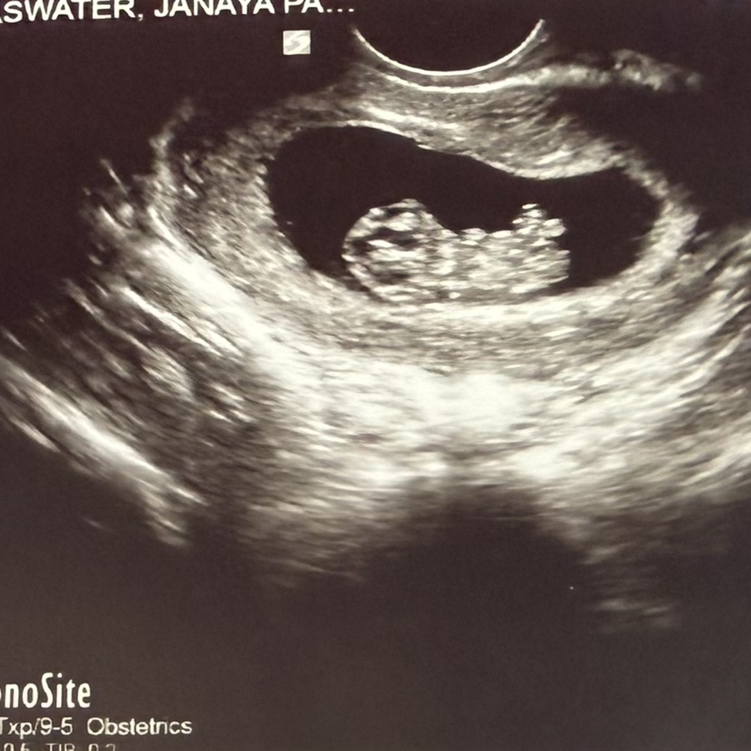 Photo shared by Janaya for their Babylist baby registry.