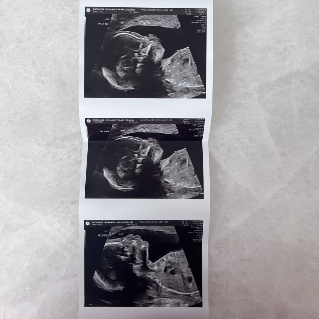 Photo shared by Agata for their Babylist baby registry.