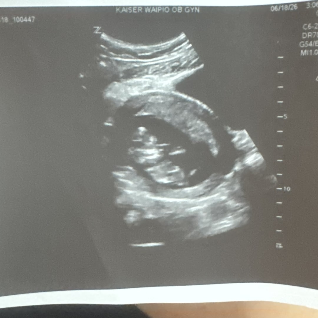 Photo shared by Jasmine for their Babylist baby registry.