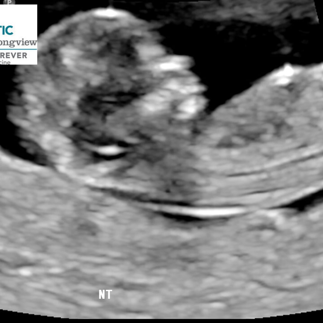 Photo shared by Haley for their Babylist baby registry.