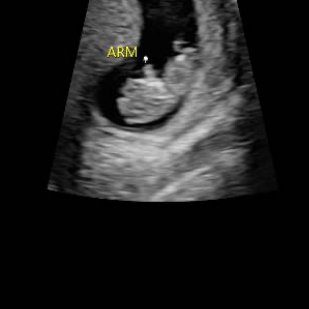 Photo shared by Keyra for their Babylist baby registry.