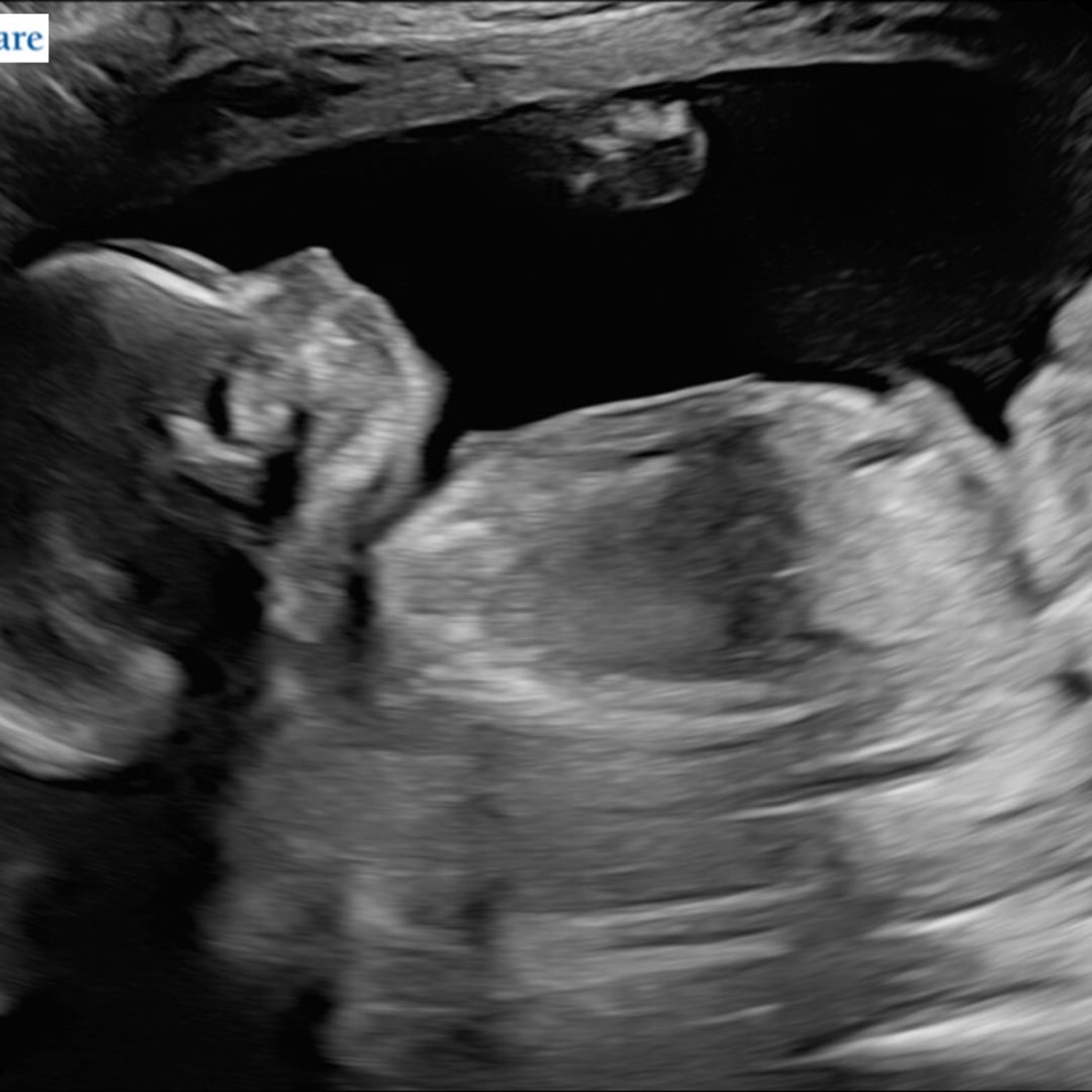 Photo shared by Brittany for their Babylist baby registry.