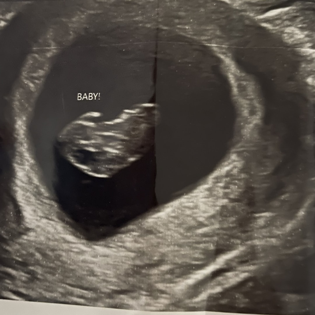 Photo shared by Alexus for their Babylist baby registry.