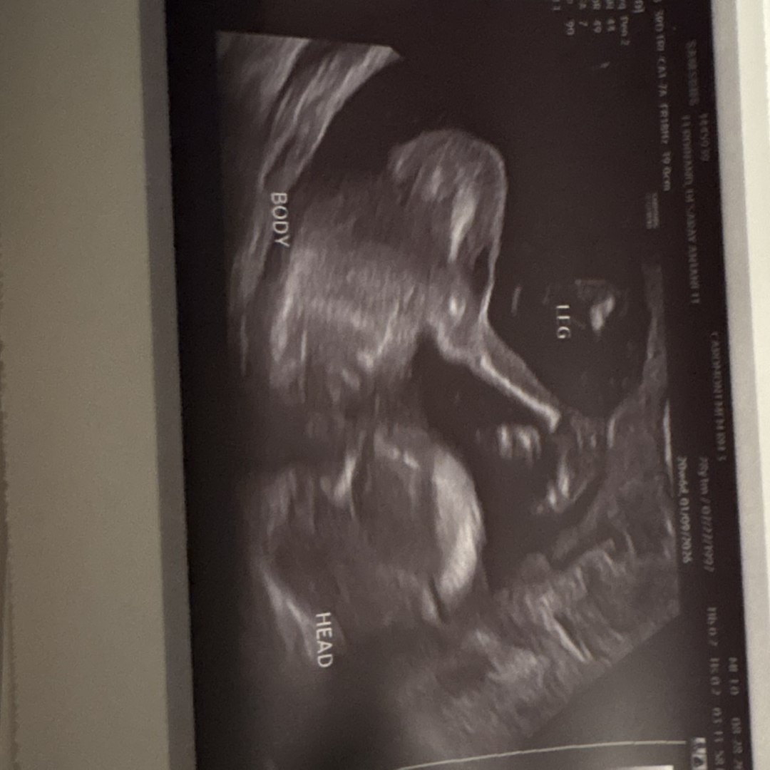 Photo shared by Desaray for their Babylist baby registry.