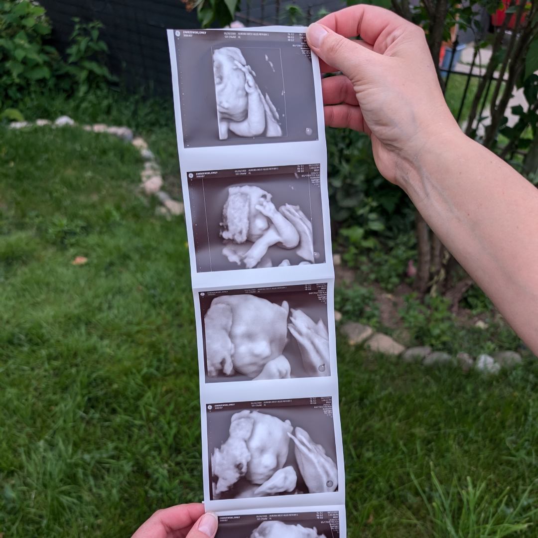 Photo shared by Emily for their Babylist baby registry.