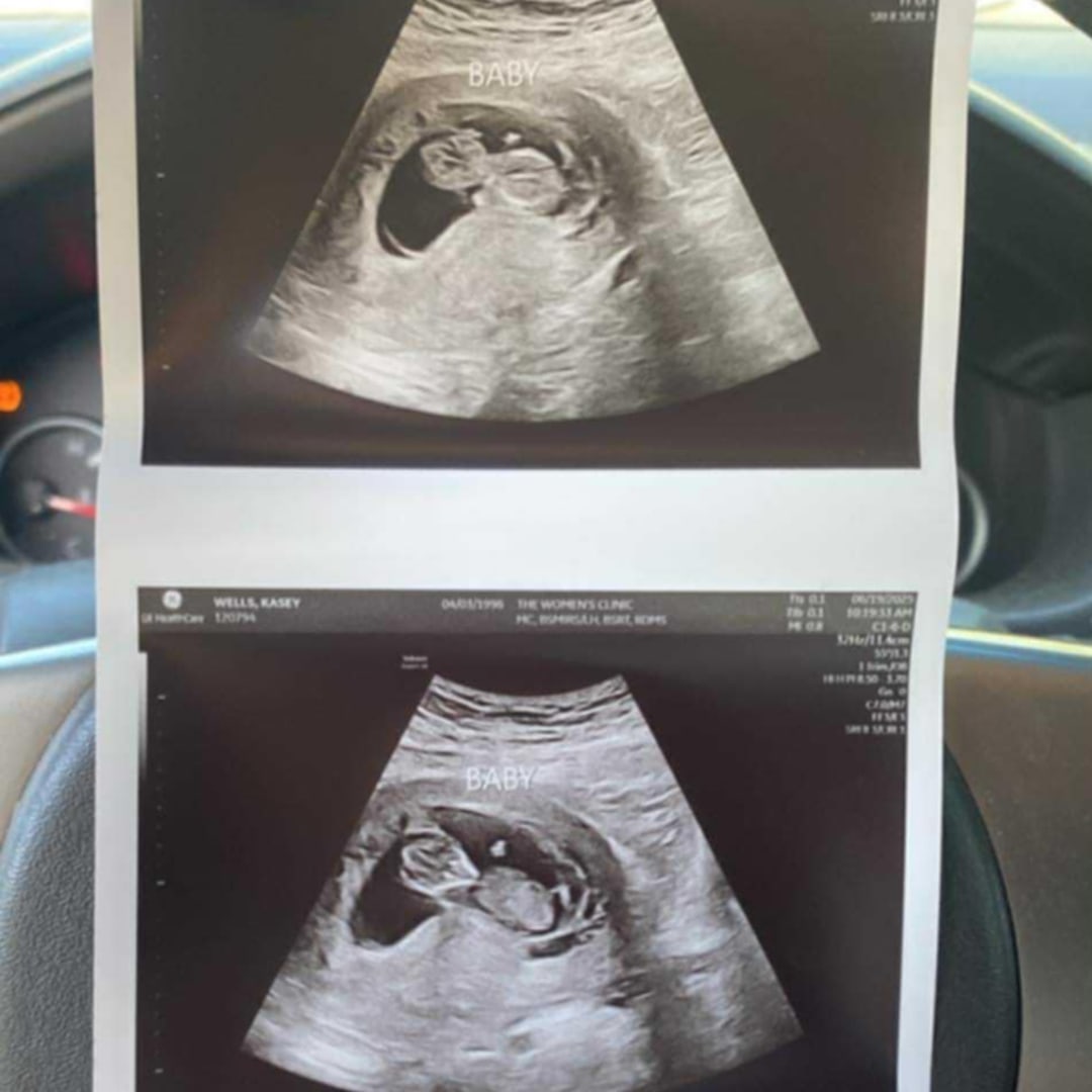 Photo shared by Kasey for their Babylist baby registry.
