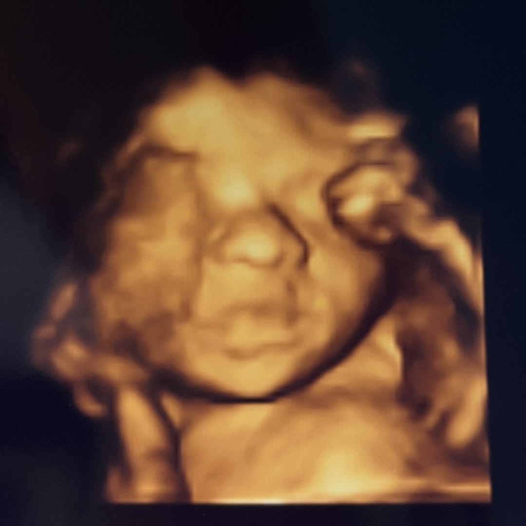 Photo shared by Emily for their Babylist baby registry.