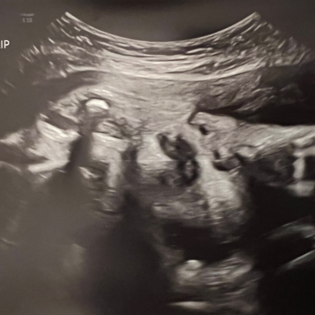 Photo shared by Zoey for their Babylist baby registry.