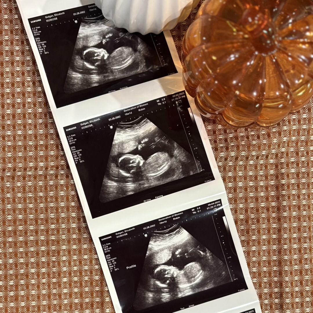 Photo shared by Ellie for their Babylist baby registry.