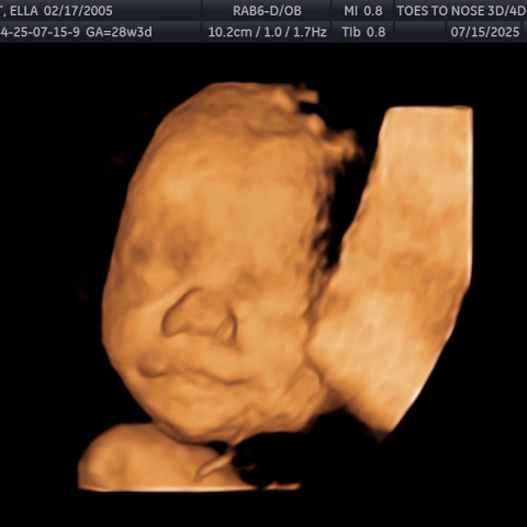 Photo shared by Ella for their Babylist baby registry.