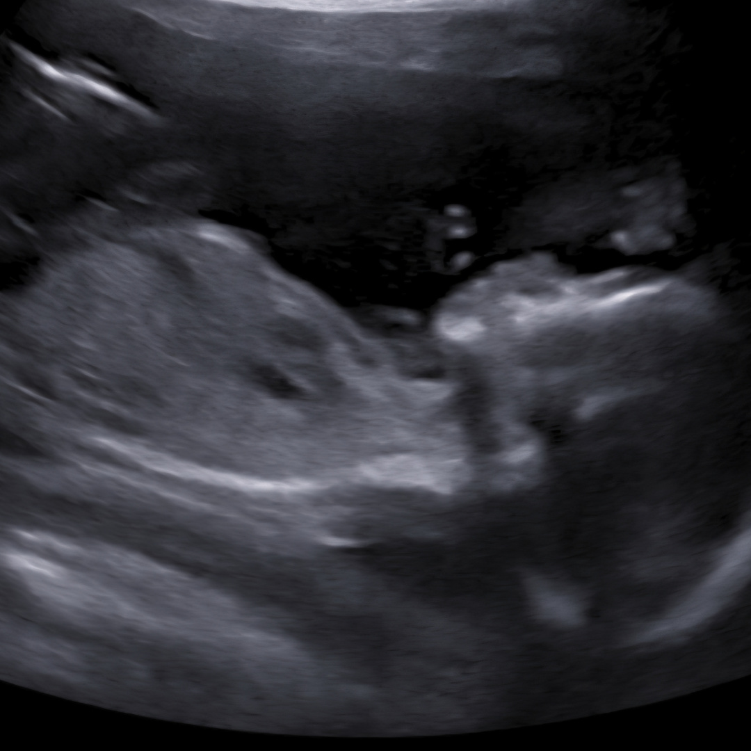Photo shared by Ashleigh for their Babylist baby registry.