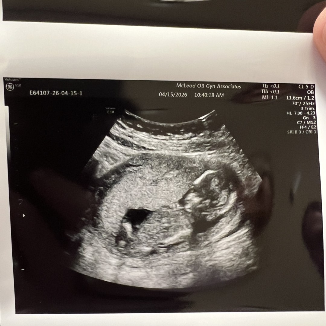 Photo shared by Taylor for their Babylist baby registry.