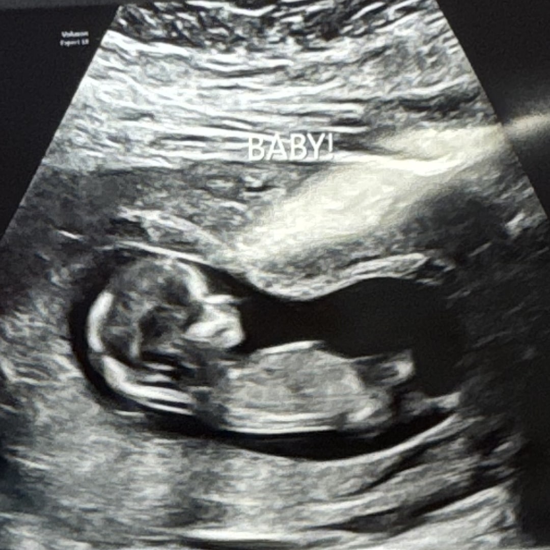 Photo shared by Elizabeth for their Babylist baby registry.