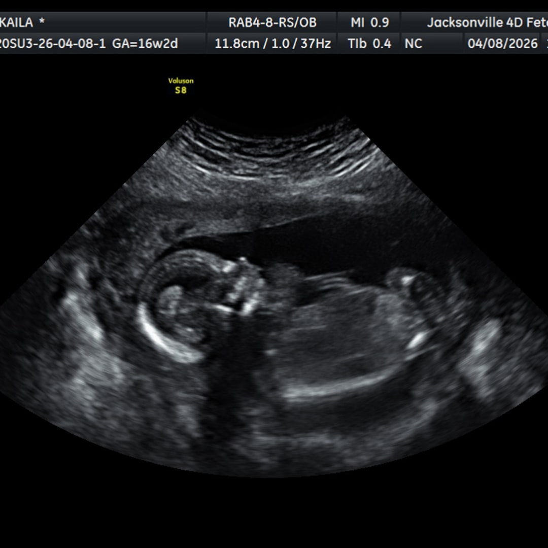 Photo shared by Kaila for their Babylist baby registry.