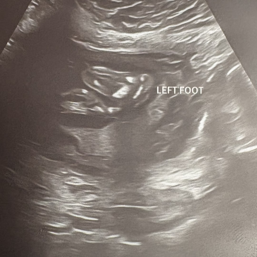 Photo shared by Kayley for their Babylist baby registry.