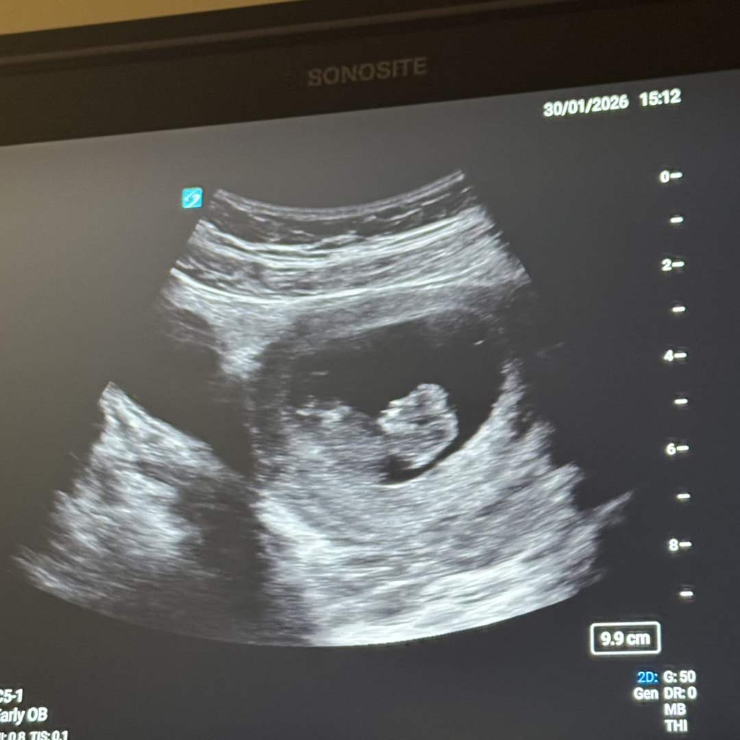 Photo shared by Mandy for their Babylist baby registry.