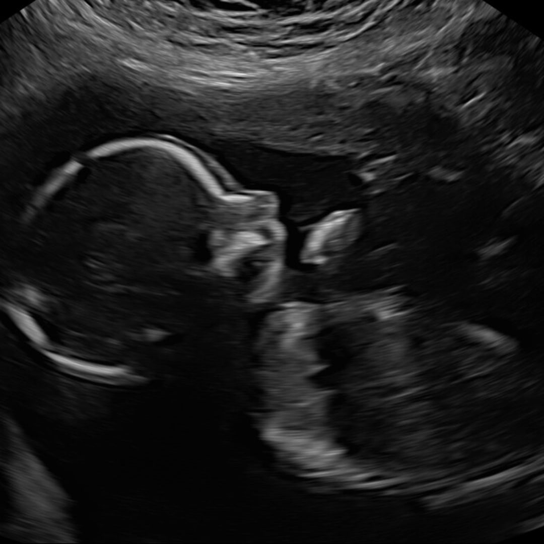 Photo shared by Alex for their Babylist baby registry.