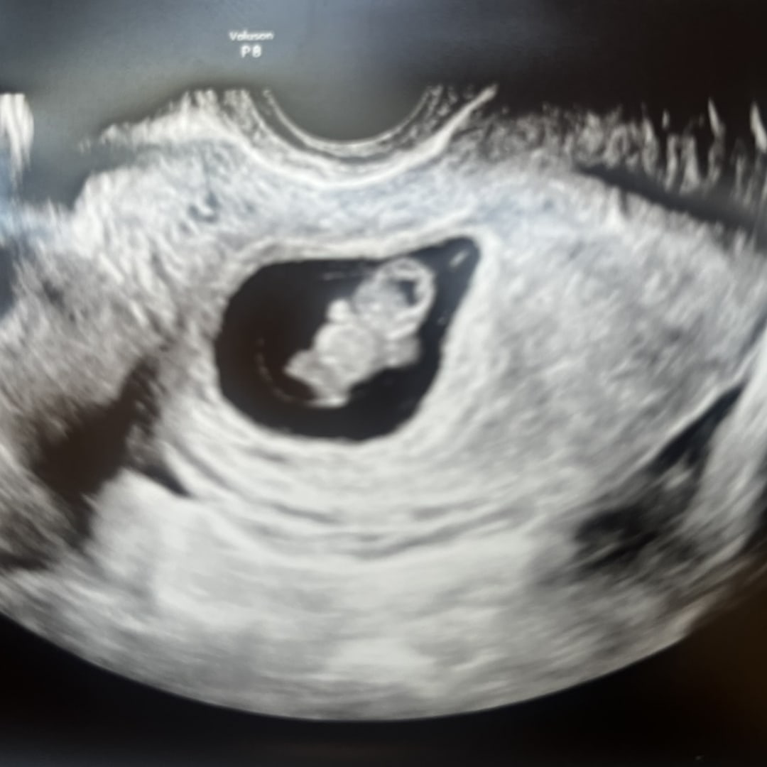 Photo shared by Raechel for their Babylist baby registry.