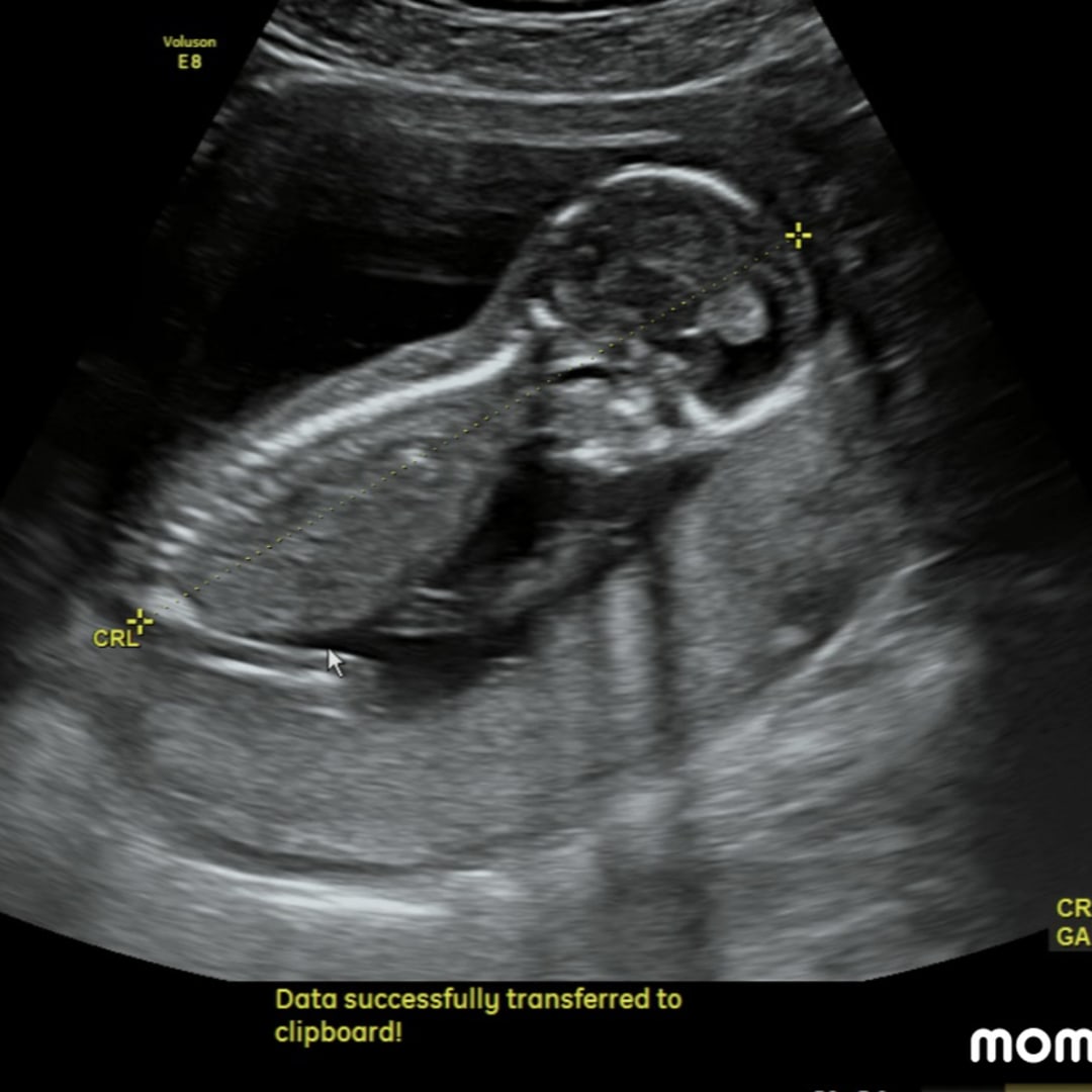 Photo shared by Cassie for their Babylist baby registry.
