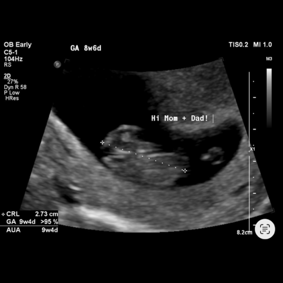 Photo shared by Aubrey for their Babylist baby registry.