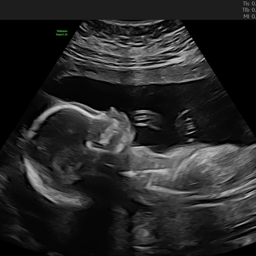 Photo shared by Cassandrah for their Babylist baby registry.