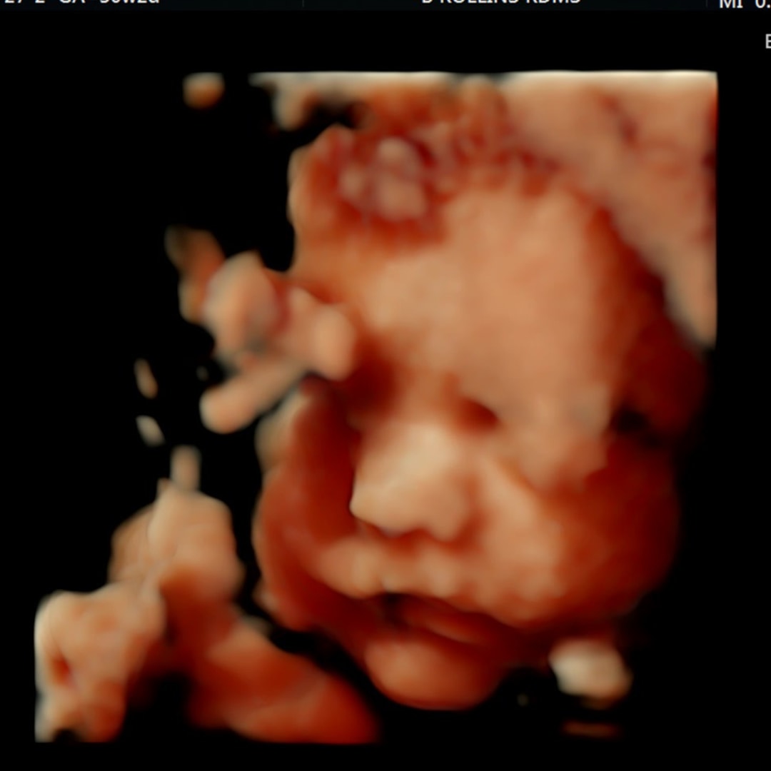 Photo shared by Brianna for their Babylist baby registry.
