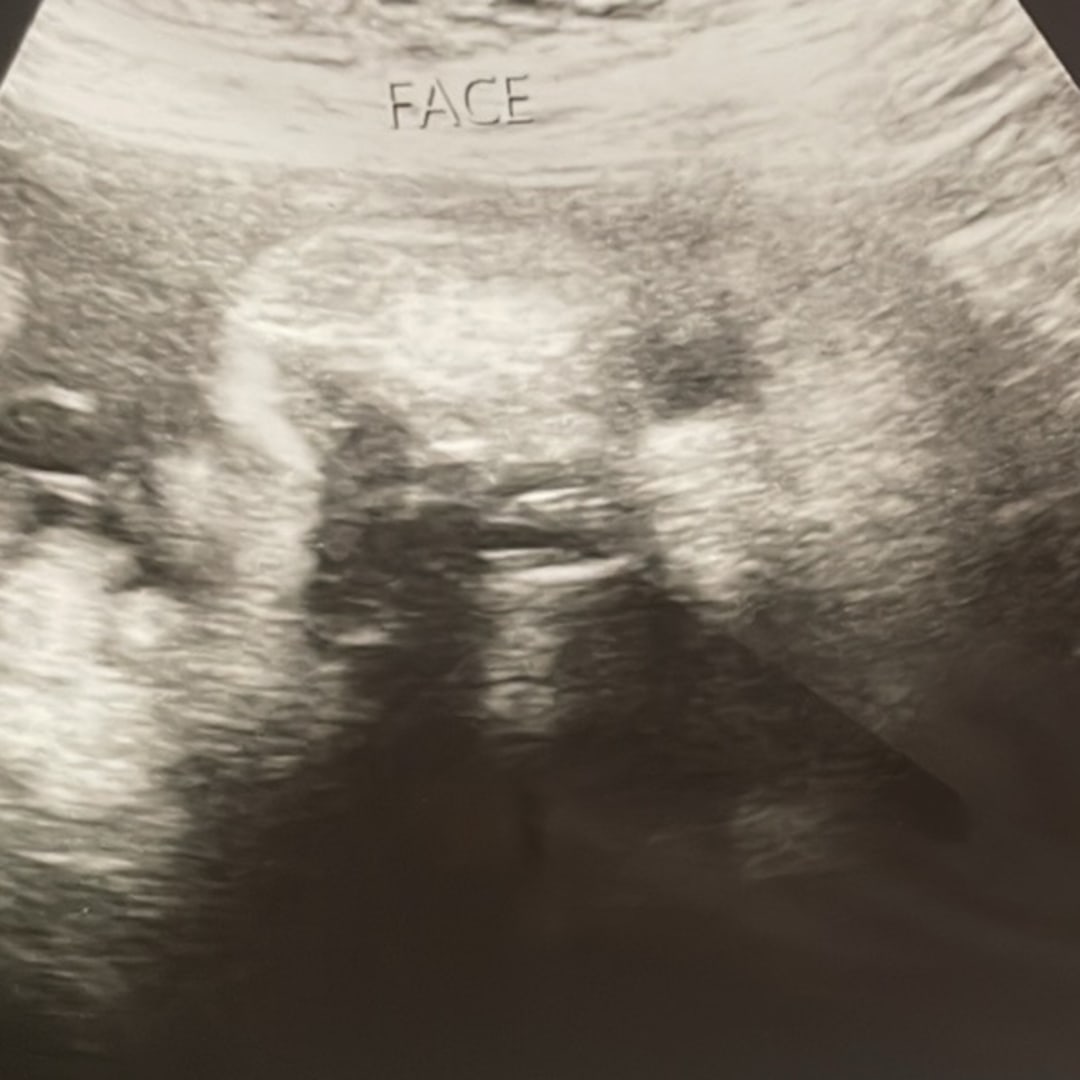 Photo shared by Belinda for their Babylist baby registry.