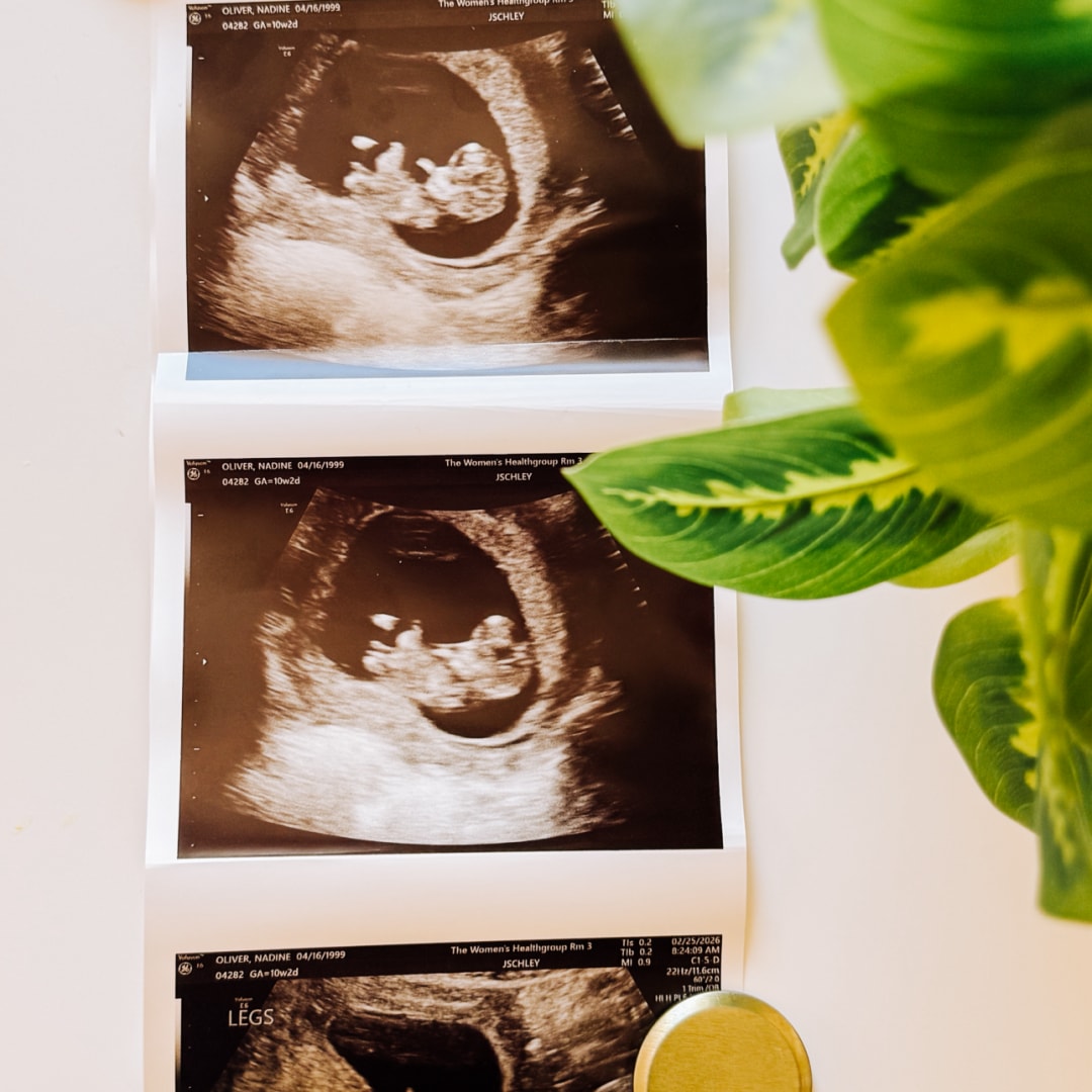 Photo shared by Nadine for their Babylist baby registry.