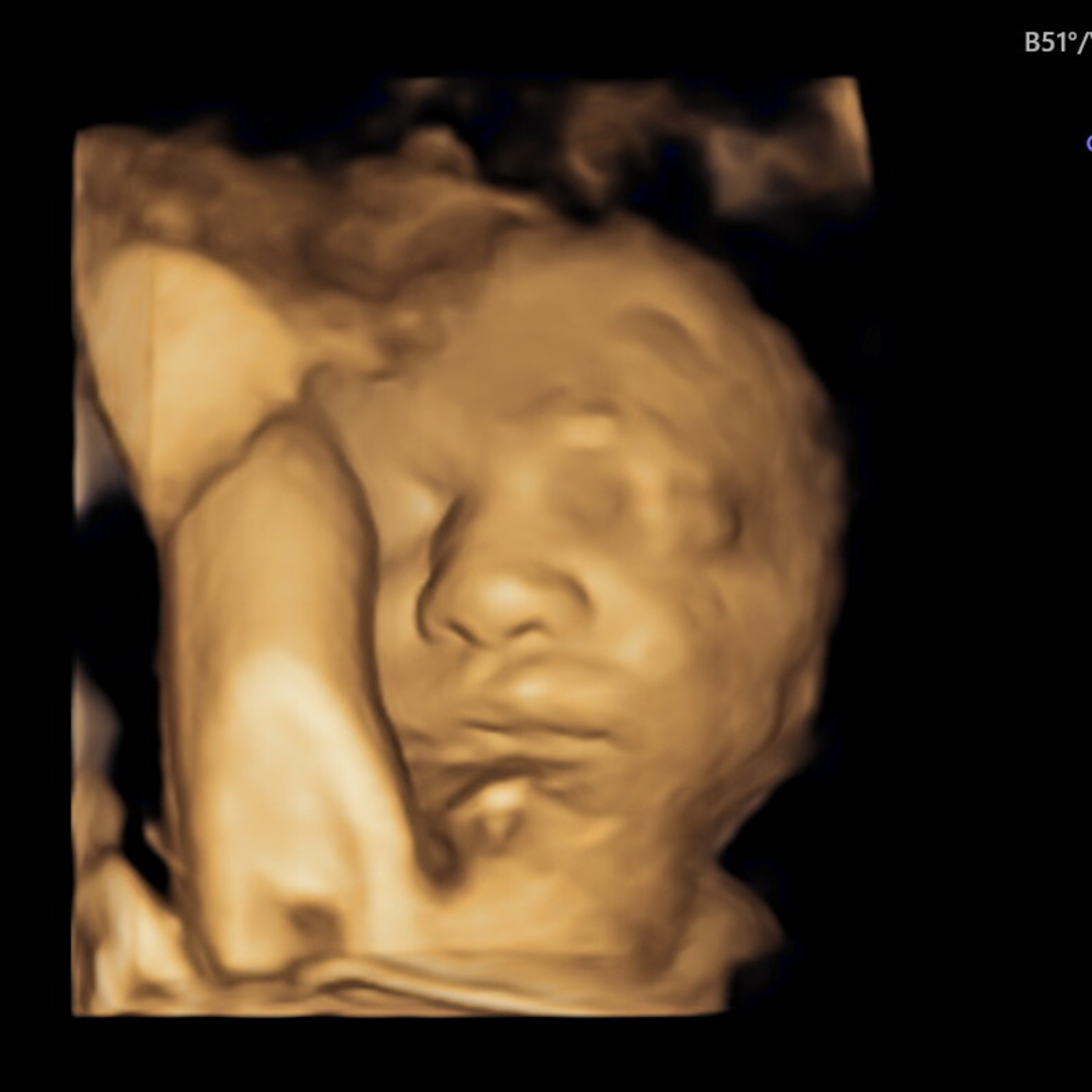 Photo shared by Austin & Ludwika for their Babylist baby registry.