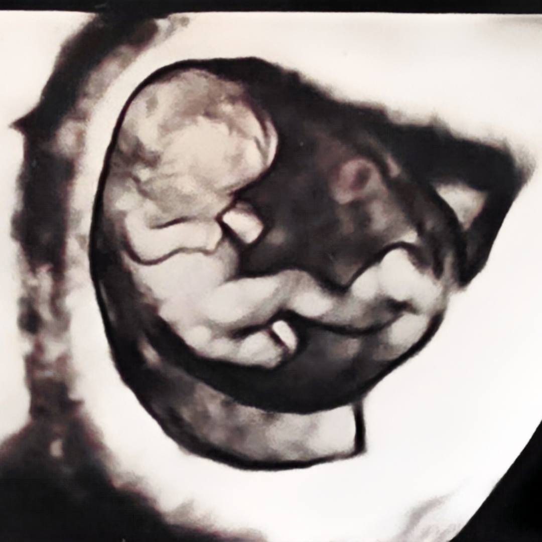 Photo shared by Natalie for their Babylist baby registry.