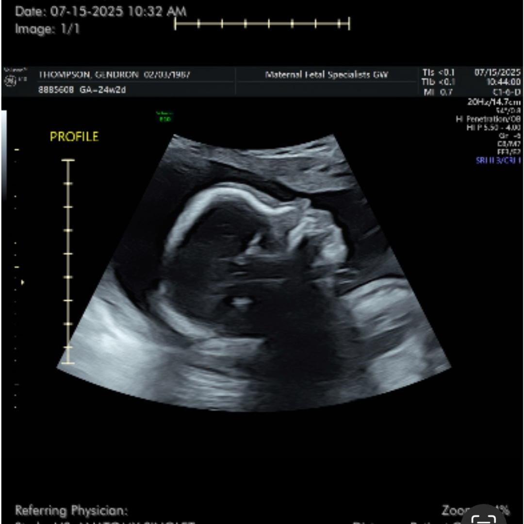 Photo shared by Gendron for their Babylist baby registry.