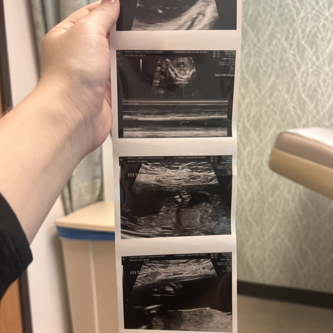 Photo shared by Gabrielle for their Babylist baby registry.