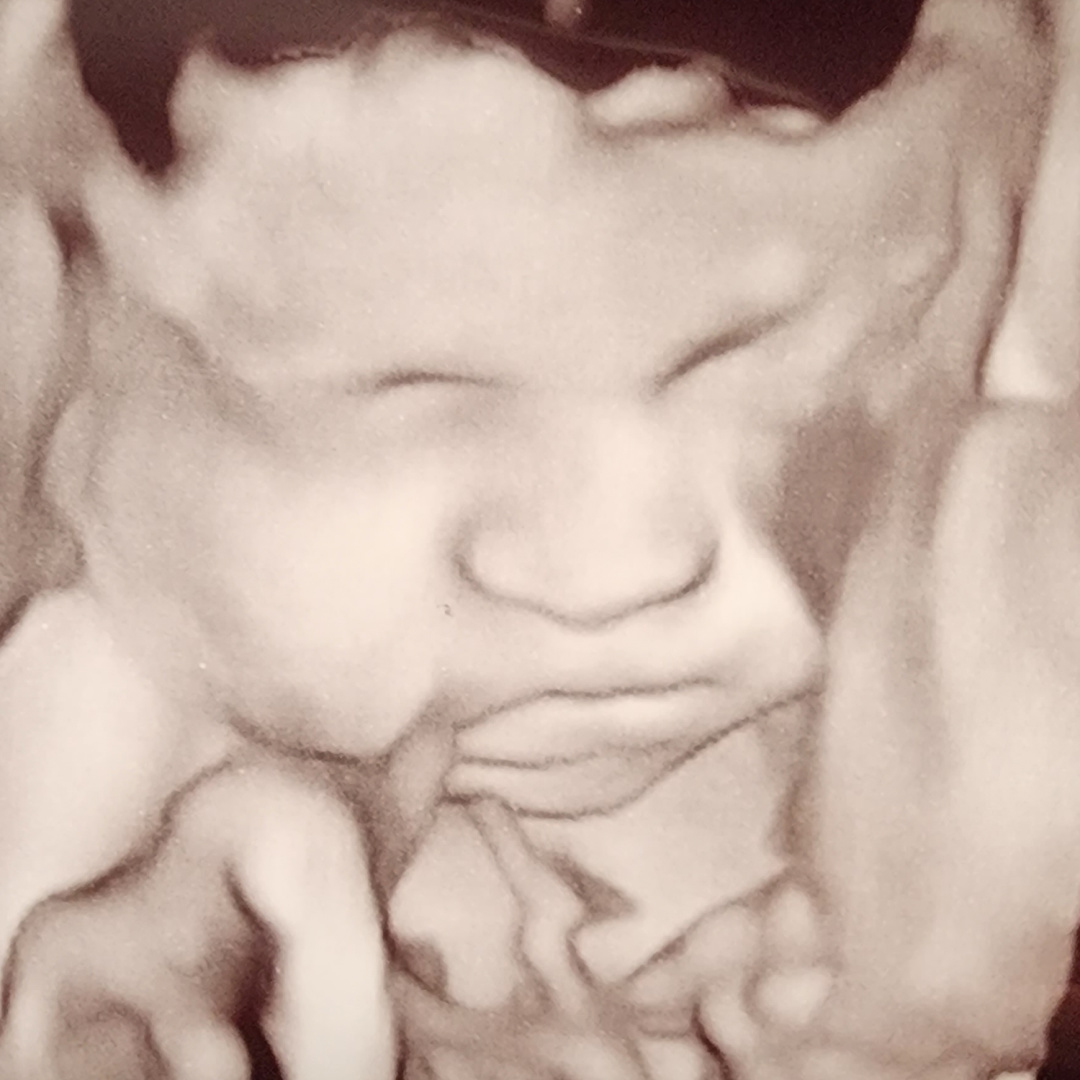 Photo shared by Audrey for their Babylist baby registry.