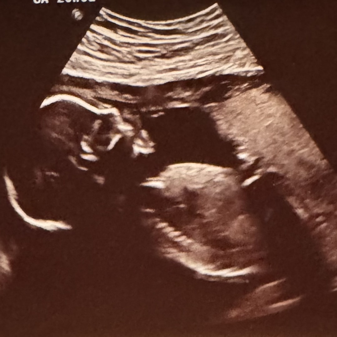 Photo shared by Amanda for their Babylist baby registry.