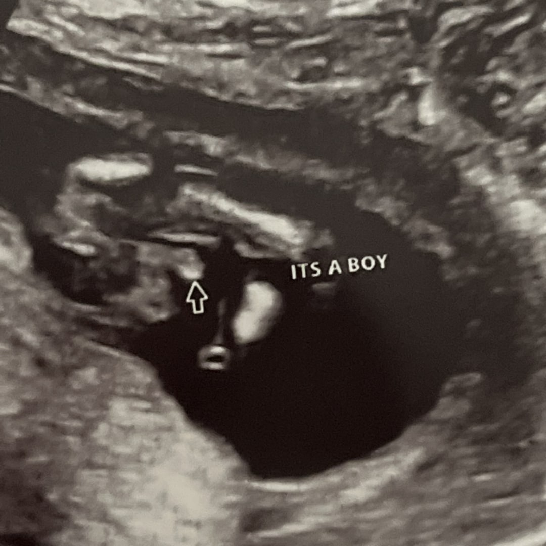Photo shared by Cali for their Babylist baby registry.