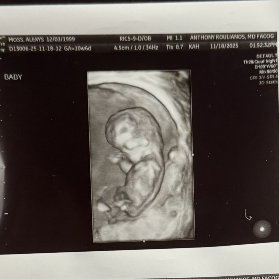 Photo shared by Alexys for their Babylist baby registry.