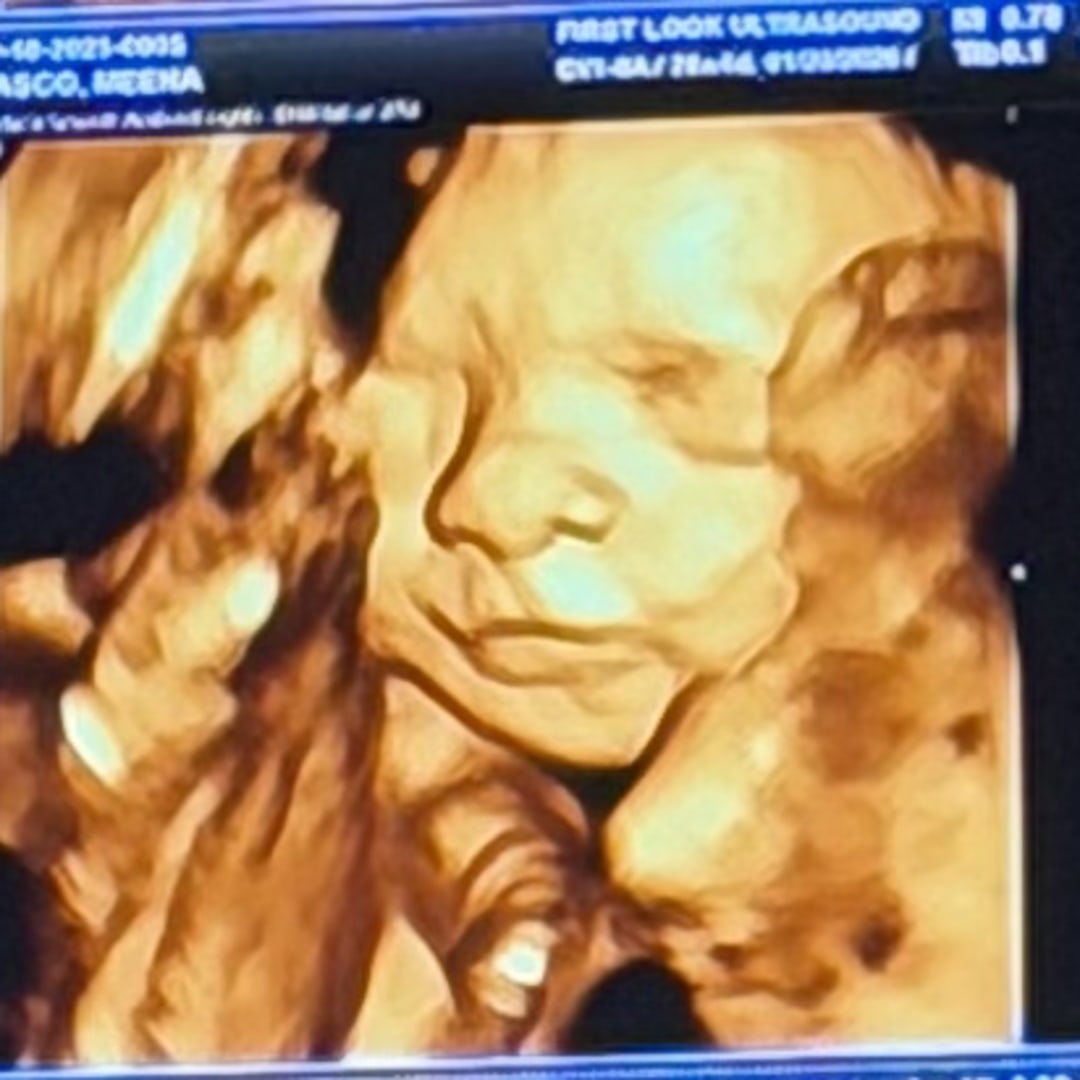 Photo shared by Phillip for their Babylist baby registry.