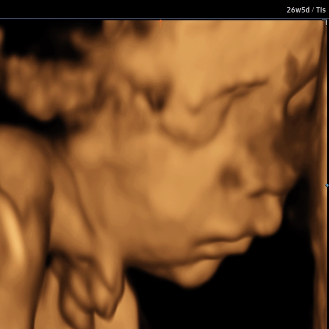 Photo shared by Arionne for their Babylist baby registry.