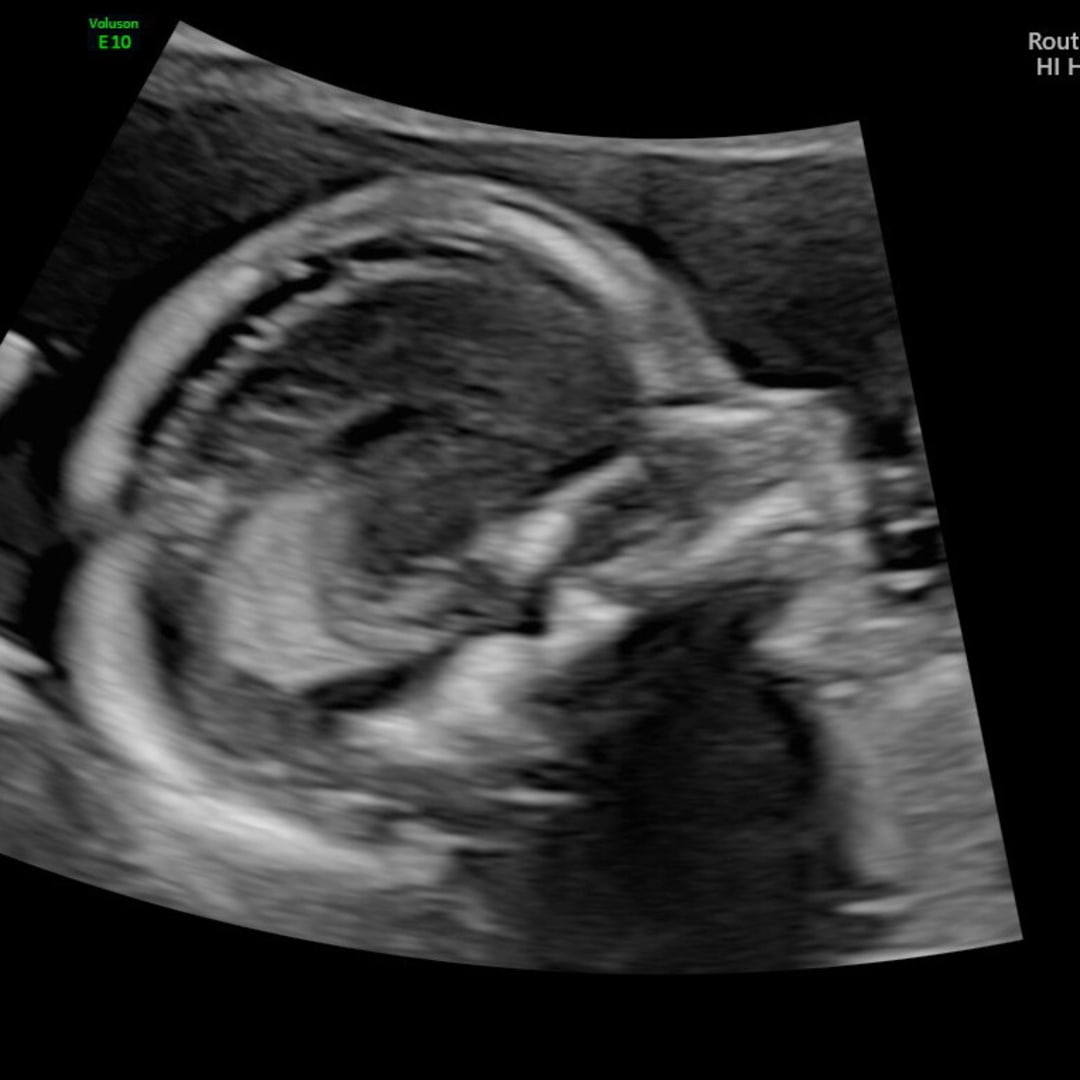 Photo shared by Meghan for their Babylist baby registry.