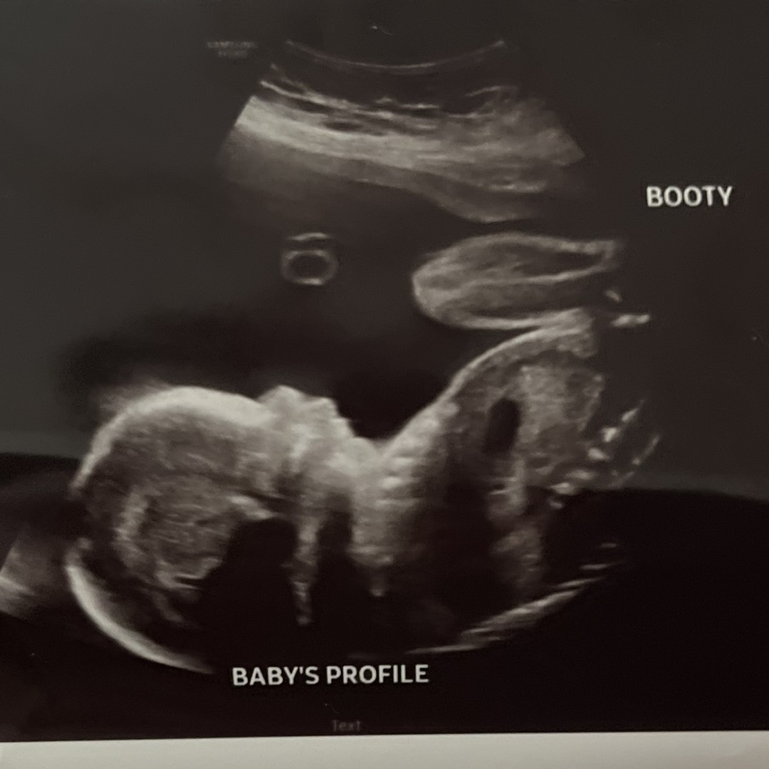Photo shared by Molly for their Babylist baby registry.