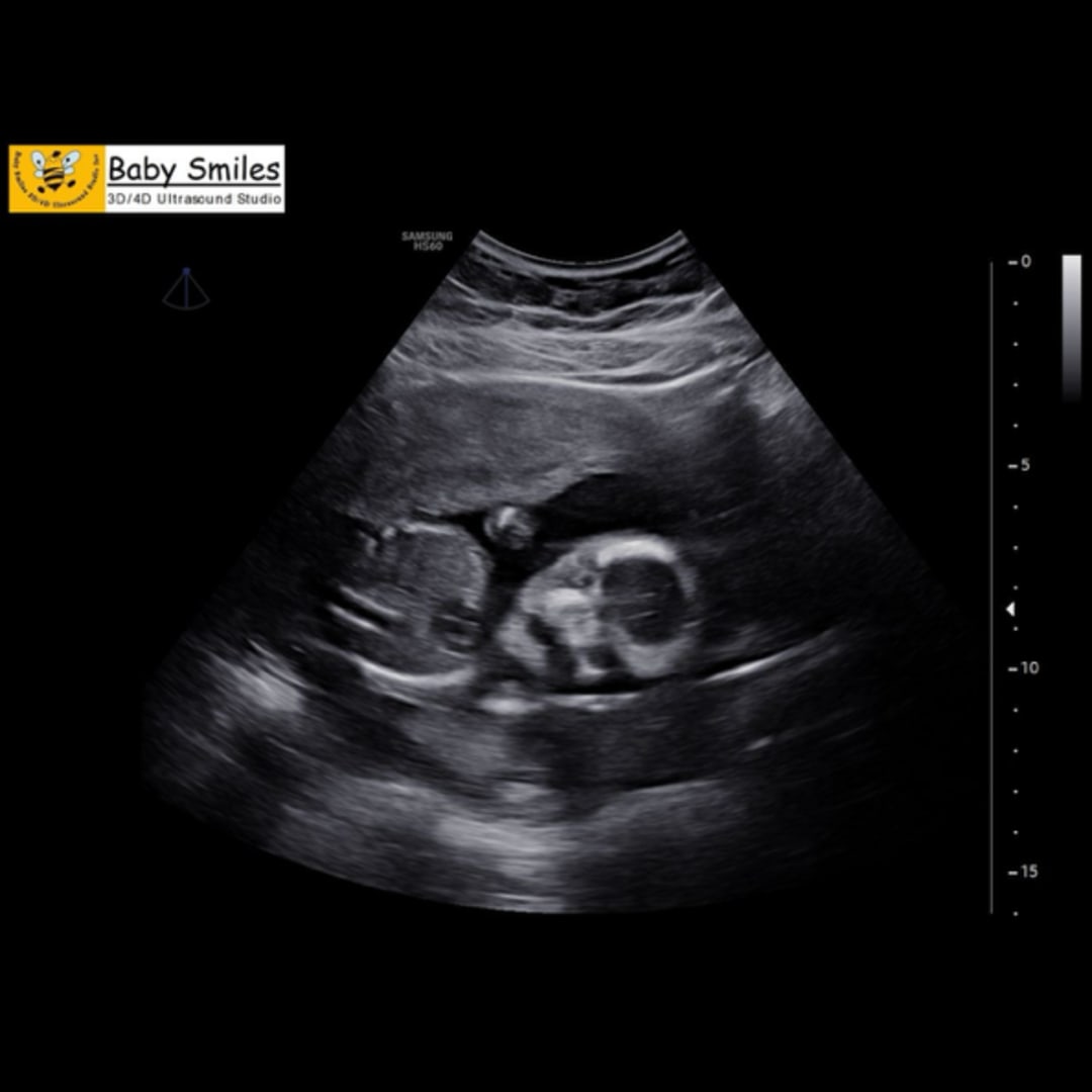 Photo shared by Emily for their Babylist baby registry.