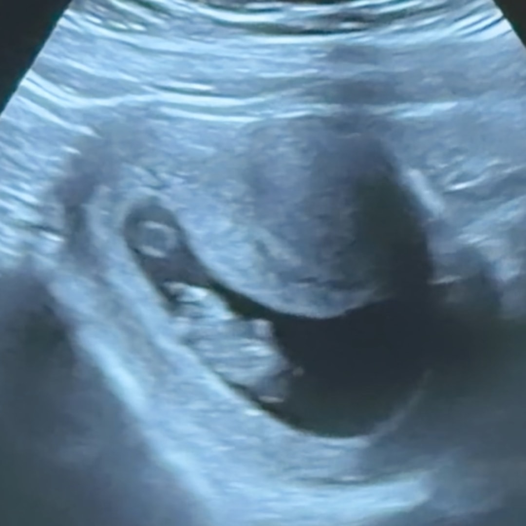 Photo shared by Casey for their Babylist baby registry.
