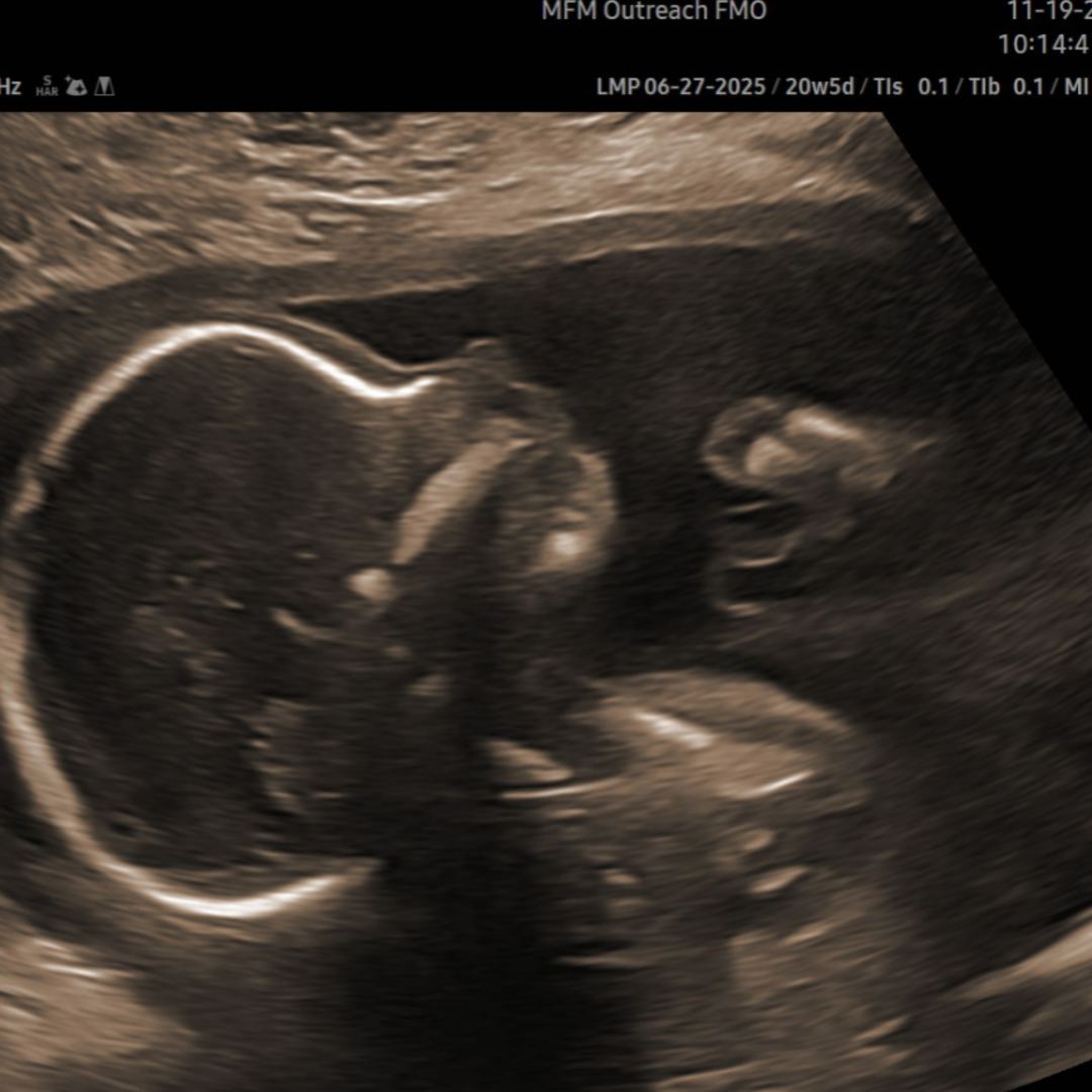 Photo shared by Bernice for their Babylist baby registry.