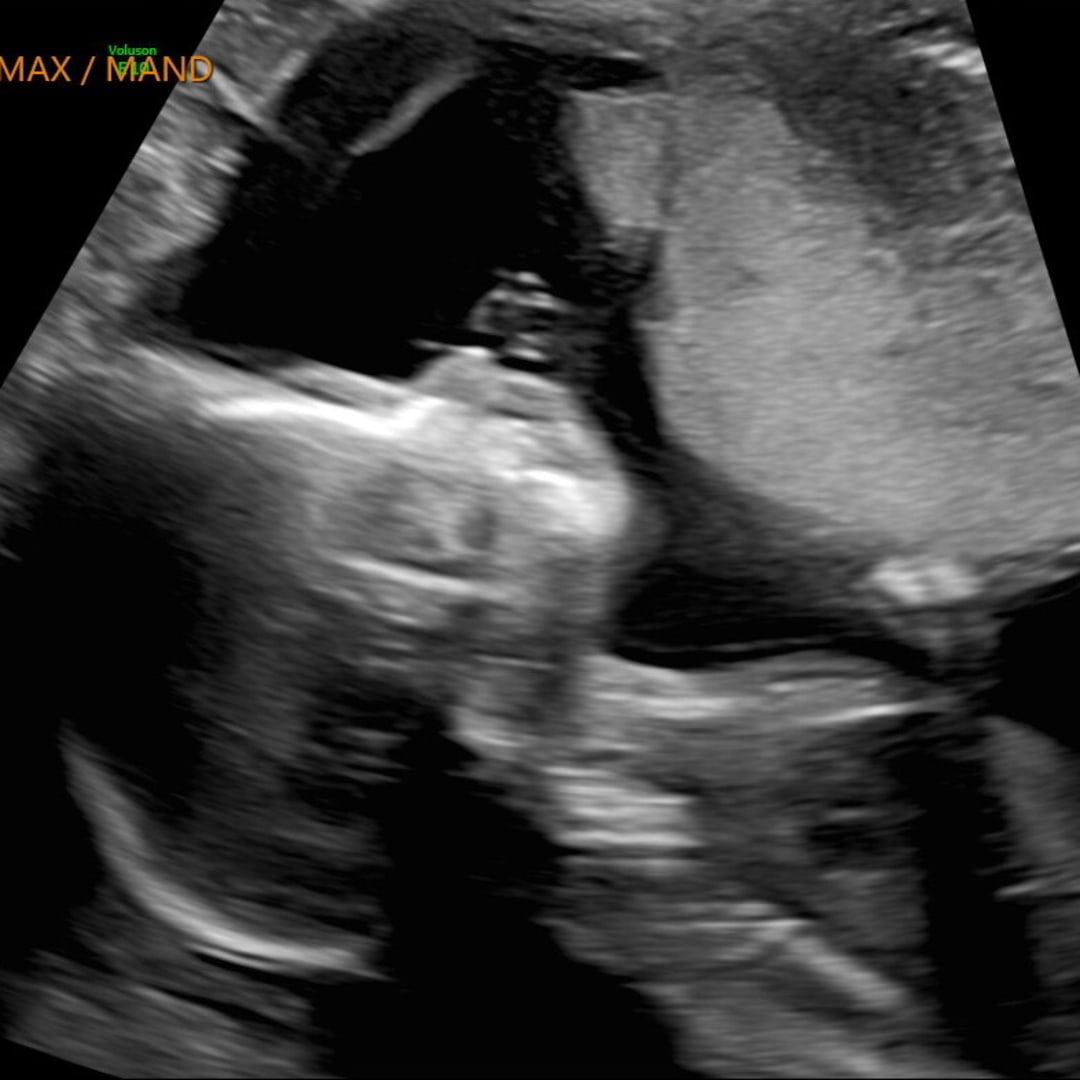 Photo shared by Brionna Coates for their Babylist baby registry.