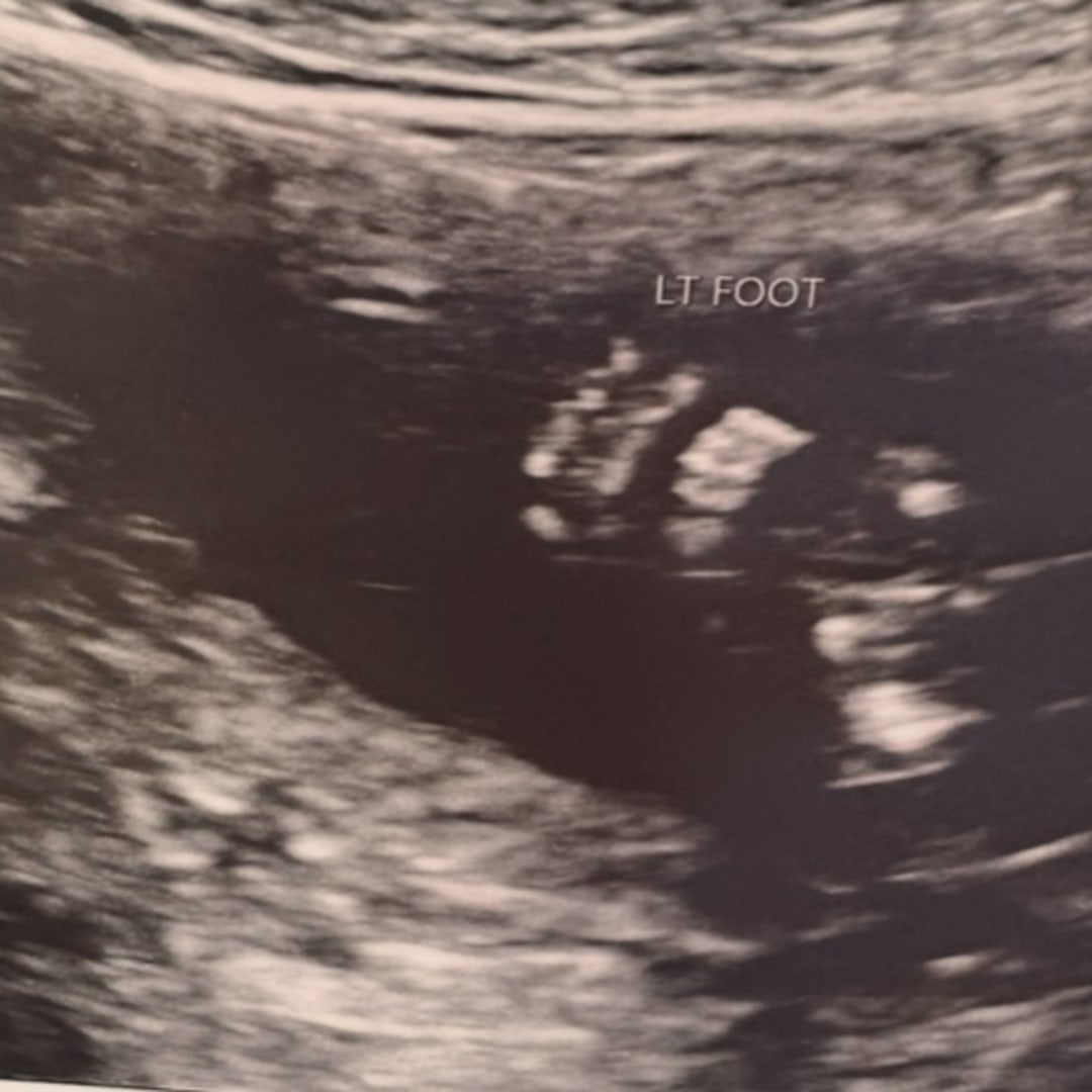 Photo shared by Kayleigh for their Babylist baby registry.