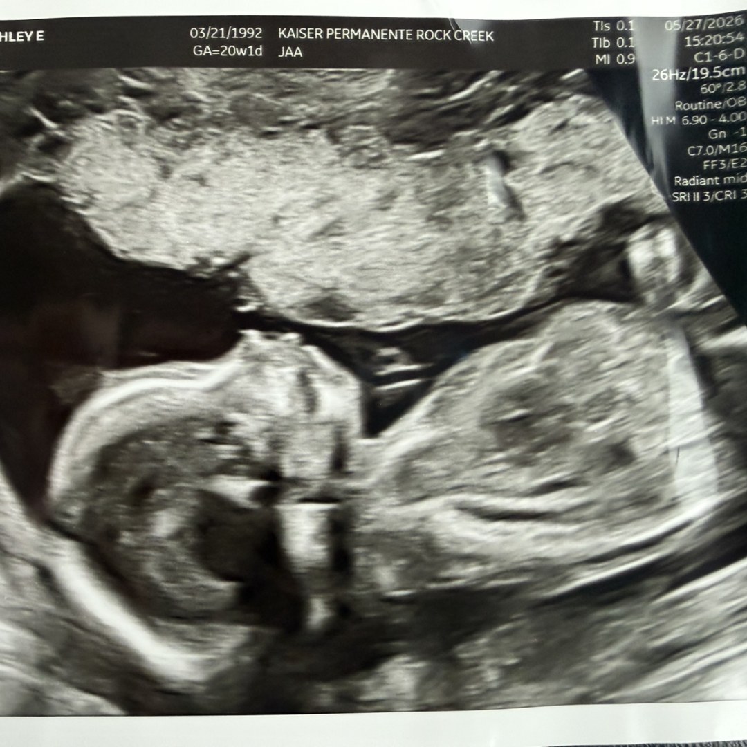 Photo shared by Ashley for their Babylist baby registry.