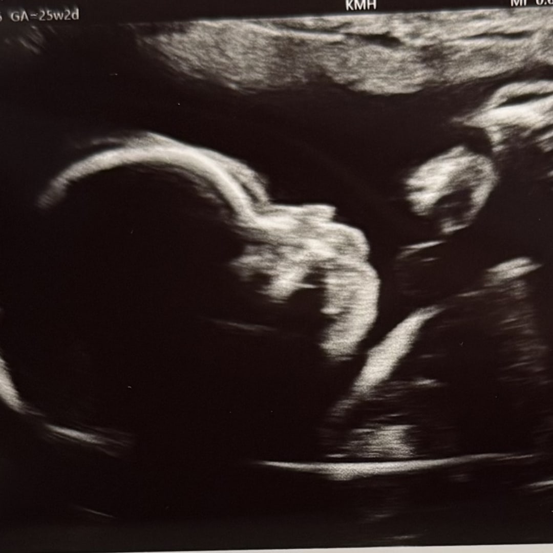 Photo shared by Myriah for their Babylist baby registry.