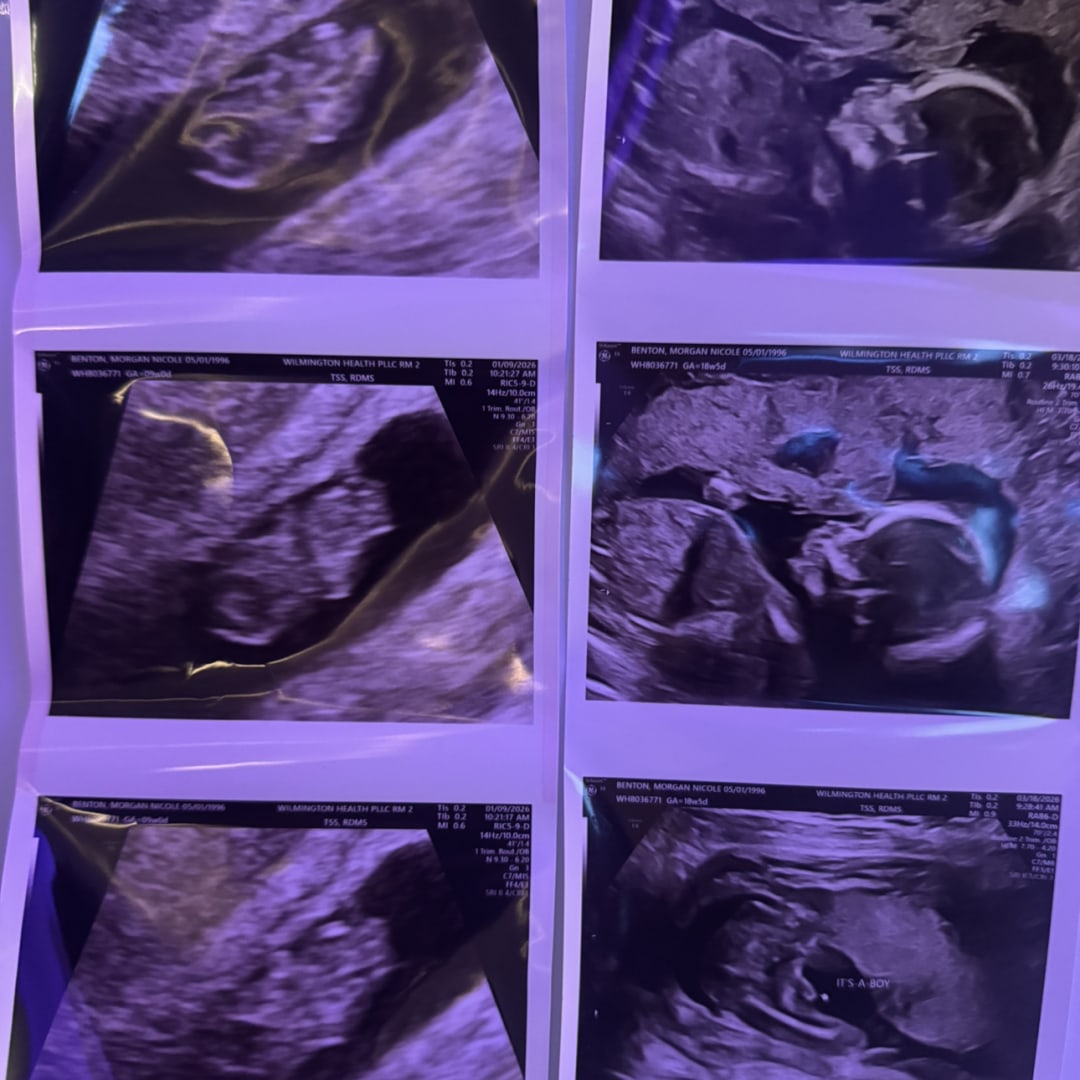 Photo shared by Morgan for their Babylist baby registry.