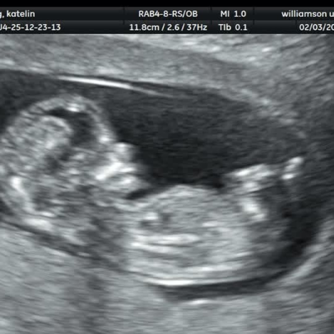 Photo shared by Katelin for their Babylist baby registry.